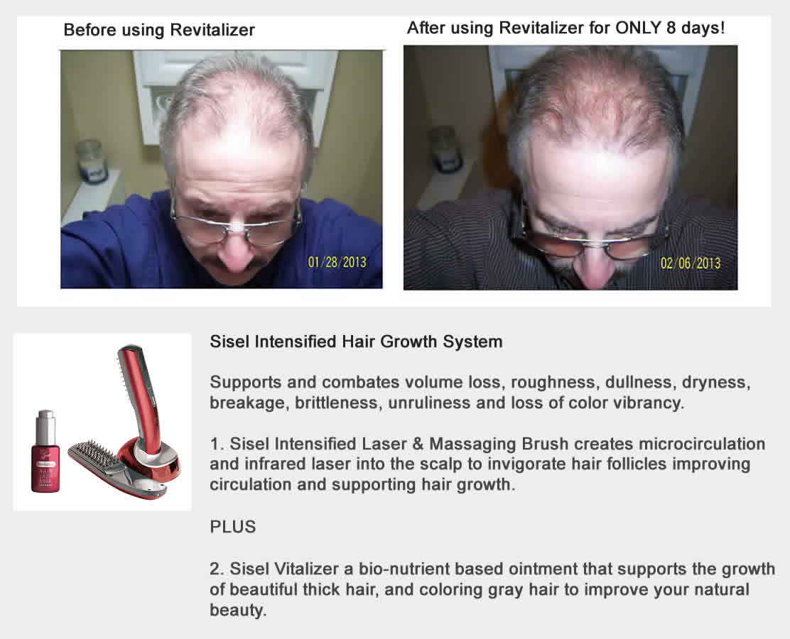 Sisel Intensified hair Growth System Revitalizer and Hair Brush