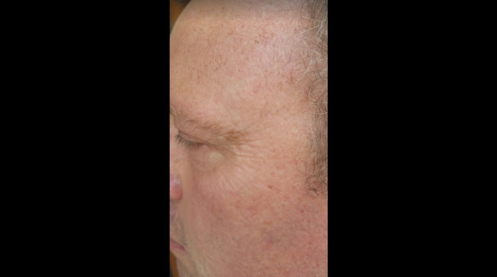 Trevor 9 Days After Sisel Skin Care - Anti Aging Timeless Renewal System