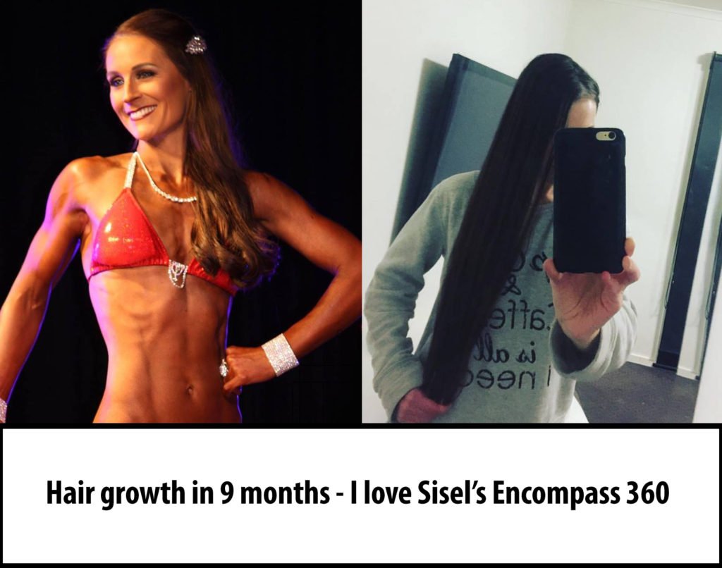 Hair Growth Accelerated Encompass 360 Sisel