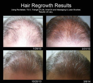 Rapid hair growth Sisel vitalizer