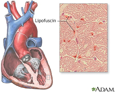 Remove Lipofuscin with the AGE Pill 