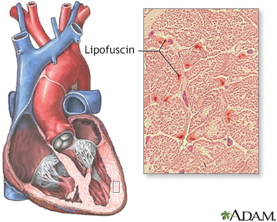 Remove Lipofuscin with the AGE Pill 