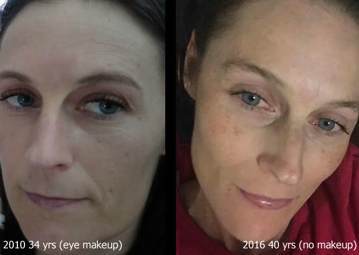Sisel Transfusium Katie before and after SISEL products. 34 years old vs 40 years old!