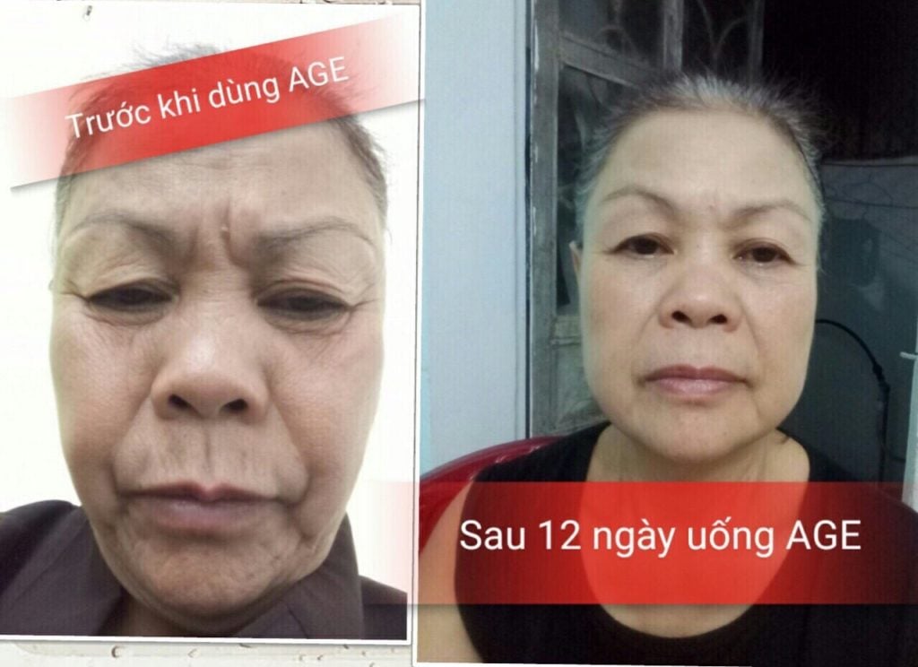 Sisel age pill glycation skin