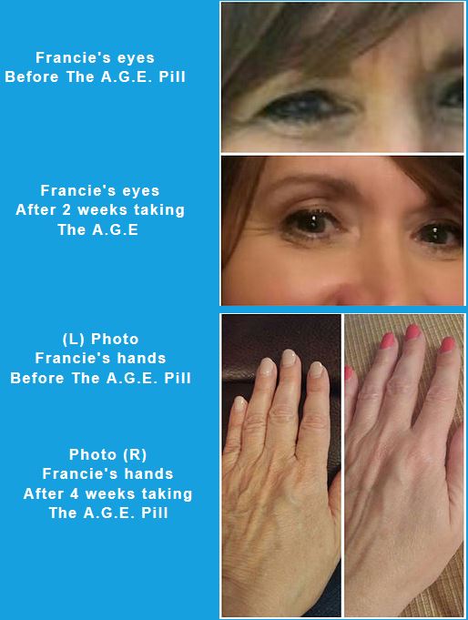 AGE Pill testimonial before and after with of Hands