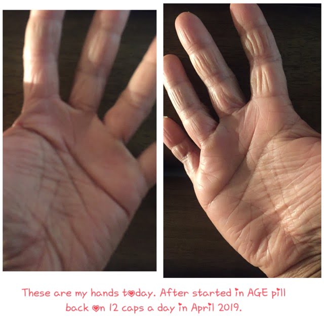 Before and After with AGE Pill Dermatitis