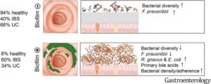 Mucosal Biofilm vs Mucoid Plaque