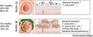 Mucosal Biofilm vs Mucoid Plaque